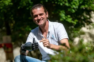 Thomas De'Kimpe, prof d'EPS au Vernet-Chaméane (Puy-de-Dôme), veut promouvoir sa main bionique