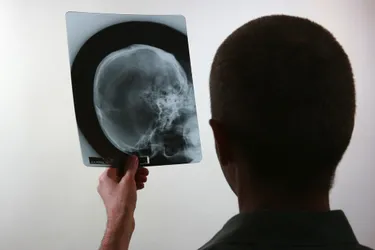 Les pharmacies d'Auvergne collectent les anciennes radiographies jusqu'au 28 janvier