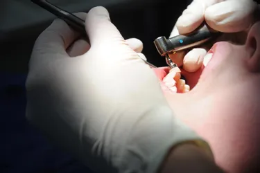 Les dentistes du Puy-de-Dôme dénoncent un "abandon total"