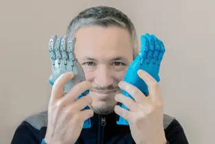 Fabriquer une prothèse de bras avec une imprimante 3D, le défi relevé par un enseignant clermontois et ses élèves