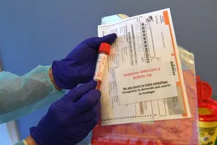 Coronavirus : deux adultes confirmés positifs ce mardi matin, 11 cas avérés dans le Puy-de-Dôme
