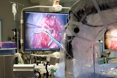 Le CHU de Clermont fusionne les techniques de chirurgie et d’imagerie médicale dans la pose d’implant cochléaire